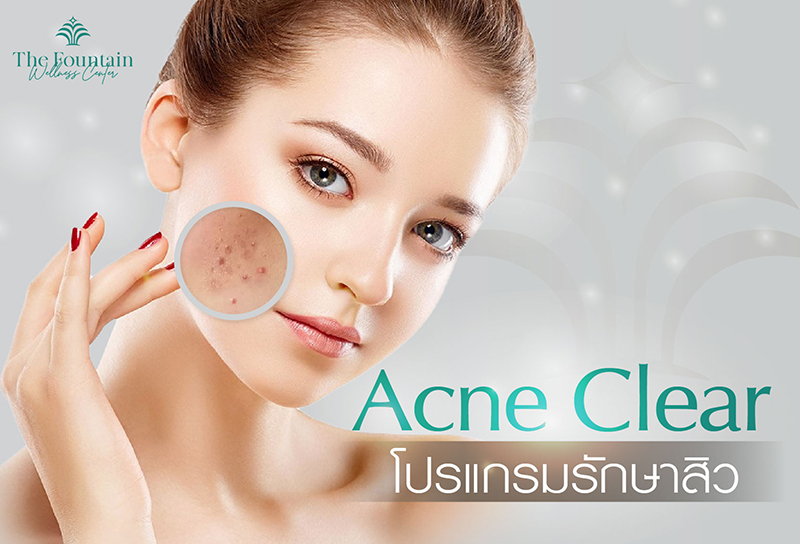 Acne Clear เริ่มต้น 1,990. -
